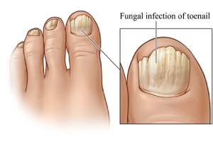 Does SupraNail really work? Powerful natural ingredients for nail repair